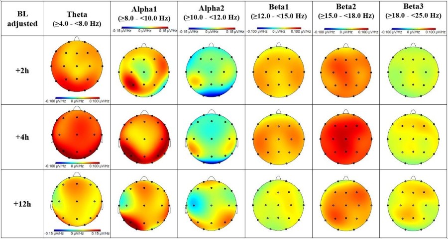 Figure 1. Topographic plot of oscillatory* spectral power change from baseline (pre-dose). *Eyes Closed