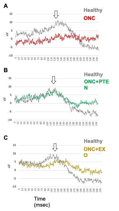 Positive impact of specific treatments on retinal health